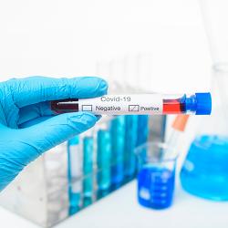 The Impact of COVID-19 on PCR Liquid Handling Procedures
