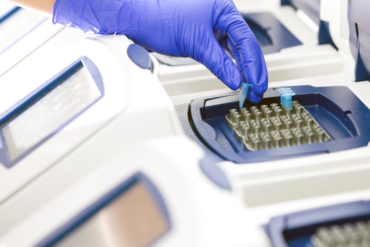 qPCR